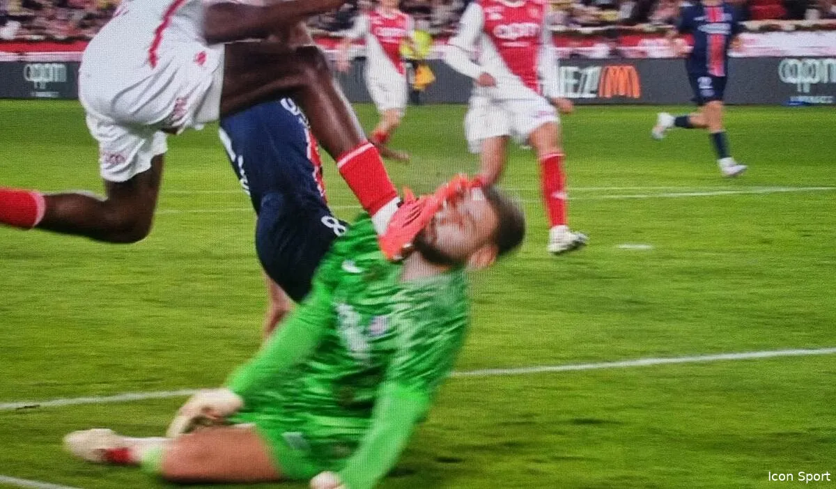 psg donnarumma sorti apres une violente semelle au visage donnarumma 385579