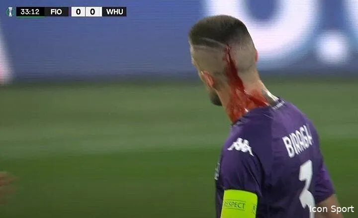 un joueur de la fiorrentina blesse a la tete par un gobelet de biere fyc0yzkxgaa40ev 361388