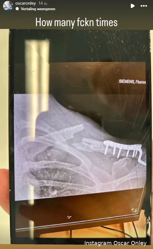 schermafbeelding 2024 04 15 094951