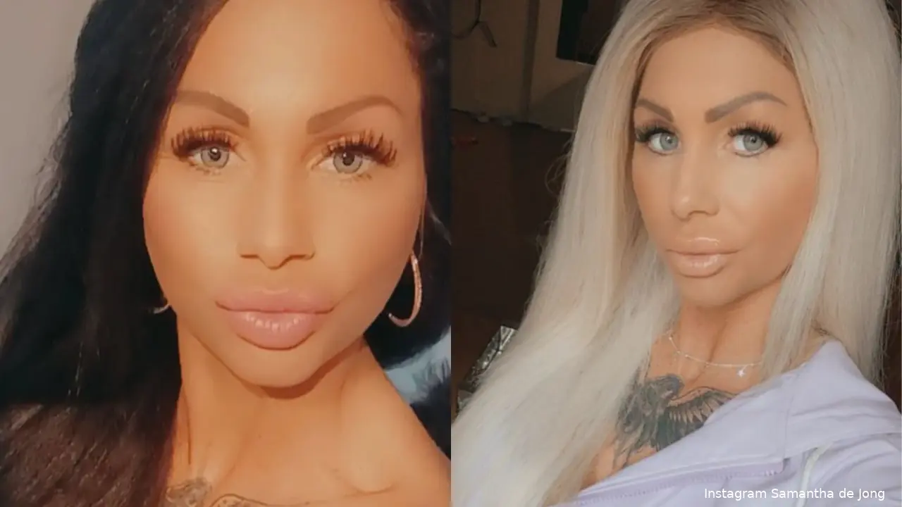 144gg