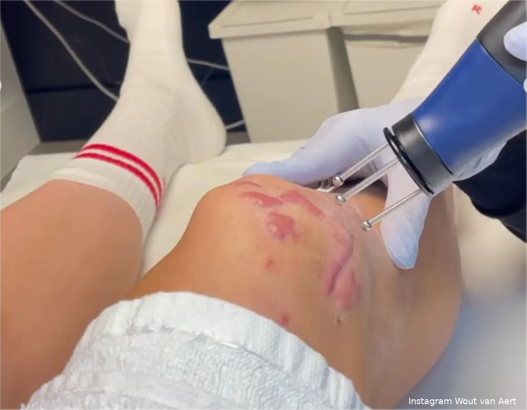 wout van aert knie