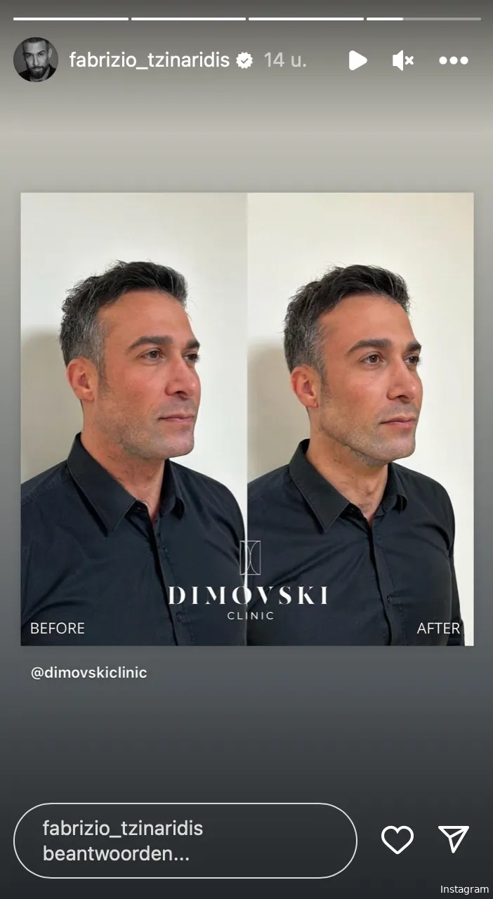 Instagram Stories (@fabrizio_tzinaridis)