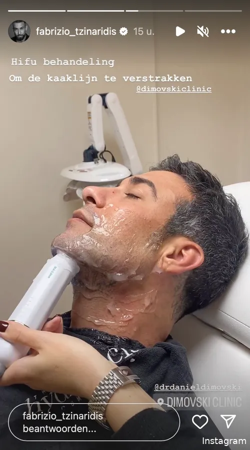 Instagram Stories (@fabrizio_tzinaridis)