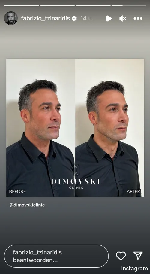 Instagram Stories (@fabrizio_tzinaridis)