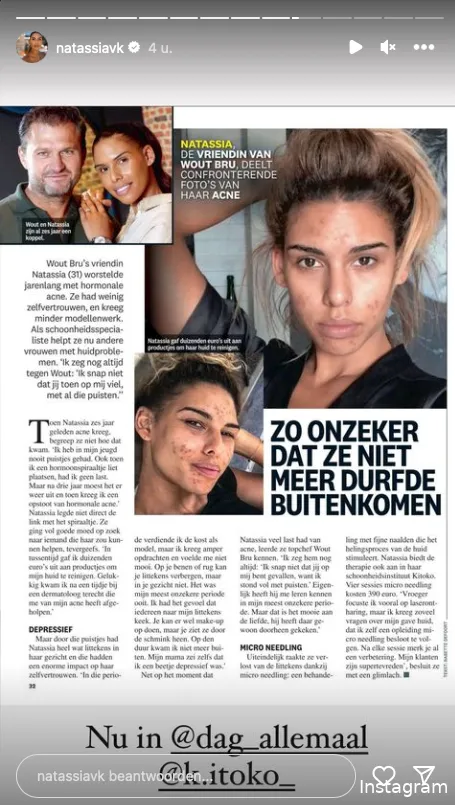 Instagram Stories (@natassiavk)