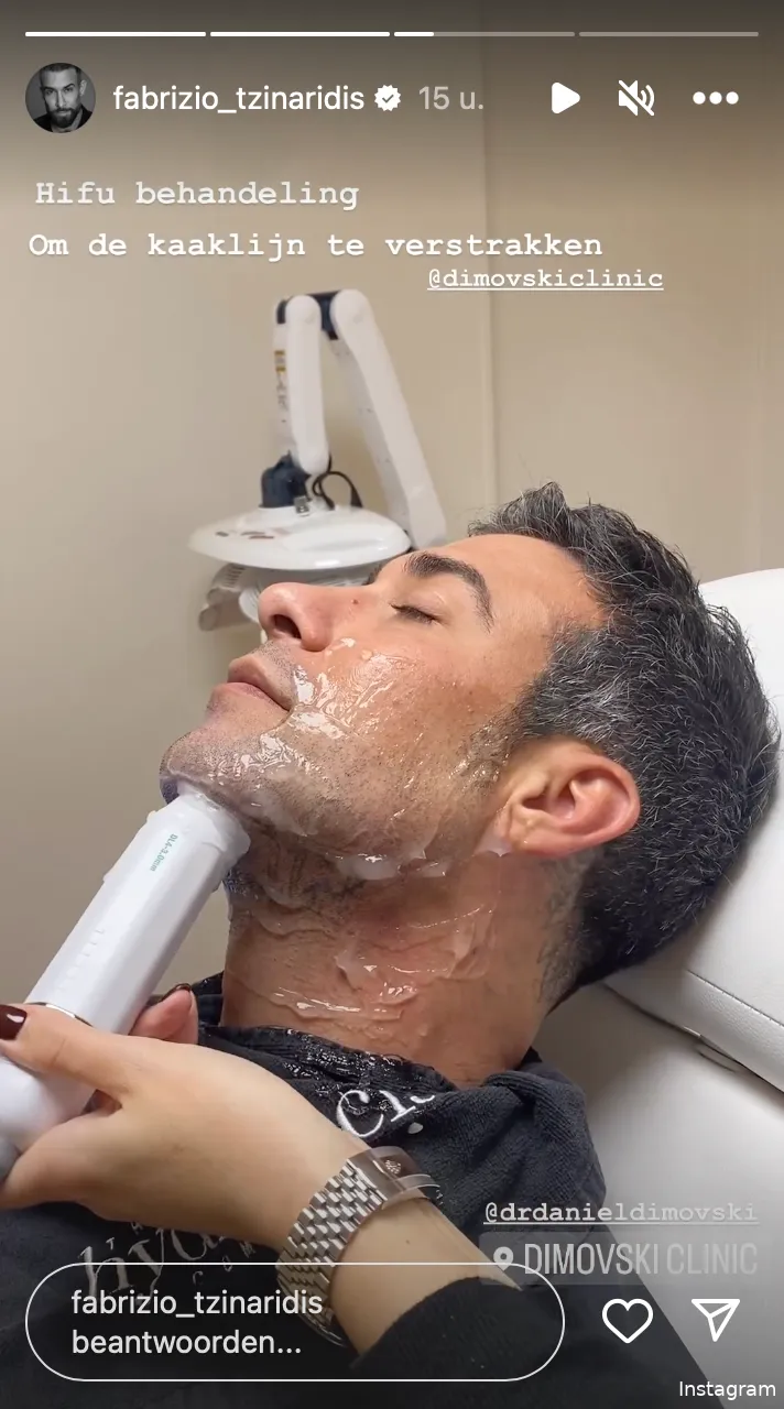 Instagram Stories (@fabrizio_tzinaridis)