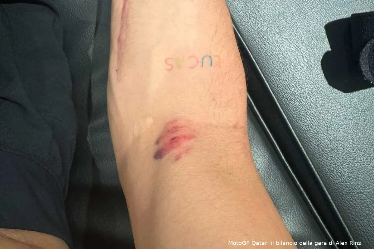 alex rins yamaha motogp braccio