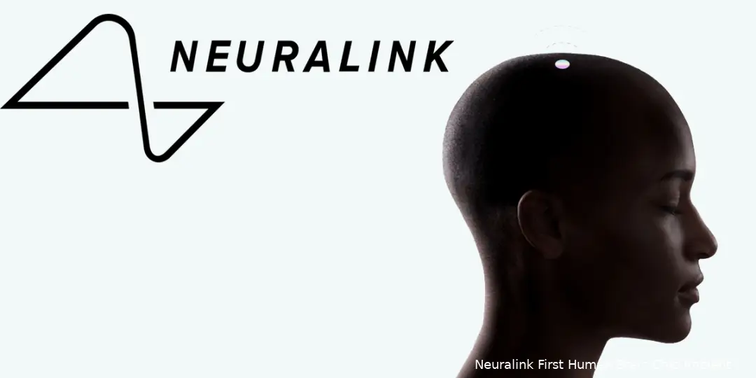neuralink 1 ibro