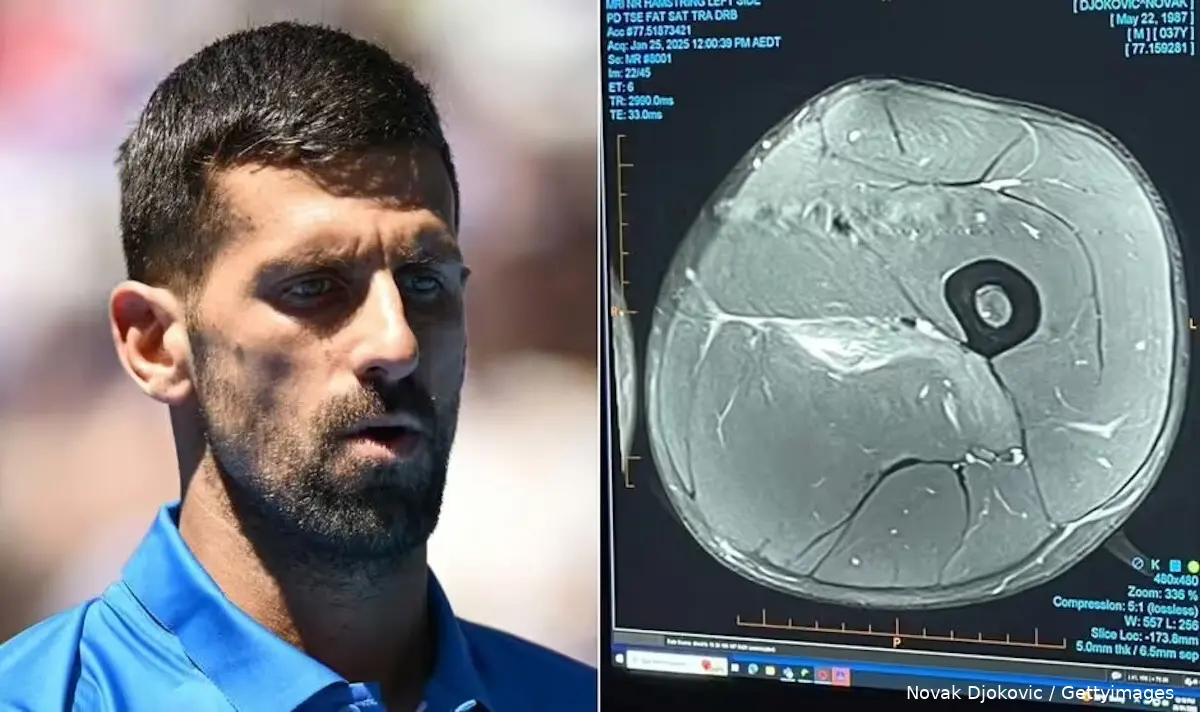 novak djokovic skade skanning