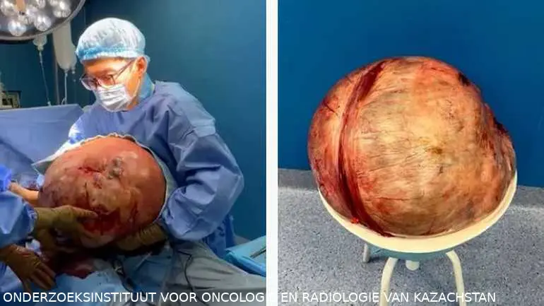 tumor