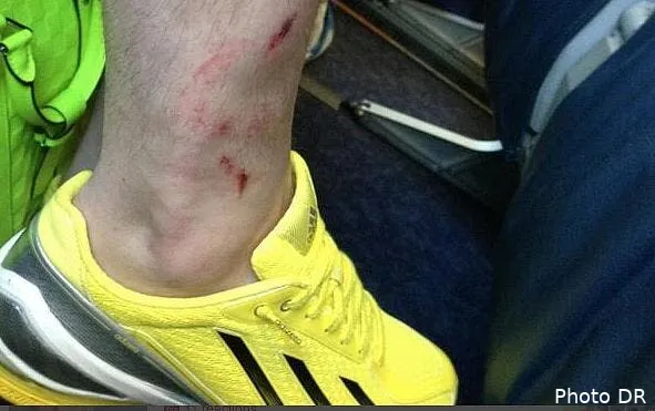 gignac n a pas triche a lorient et sa cheville le prouve capture d e cran 2013 04 28 a 08 19 1955731