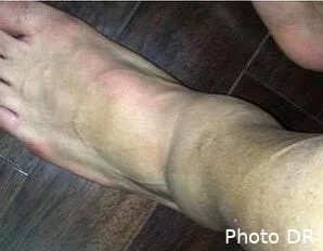 lucas tweete sur sa cheville et inquiete le psg lucas51921