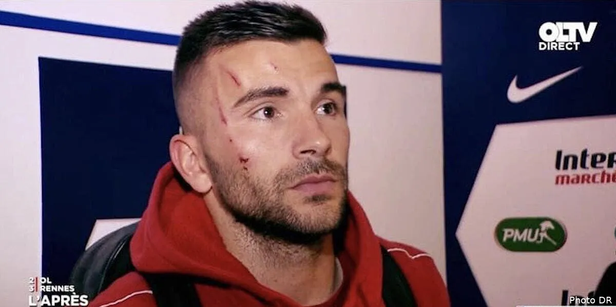 ol anthony lopes defigure coupet reclame une reaction des arbitres anthony lopes249445