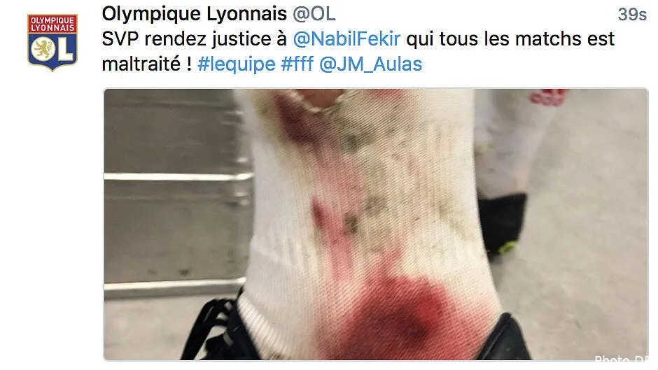 ol quand le compte twitter de lyon provoque un gros malaise capture d e cran 2018 02 17 a 12 05 09210273