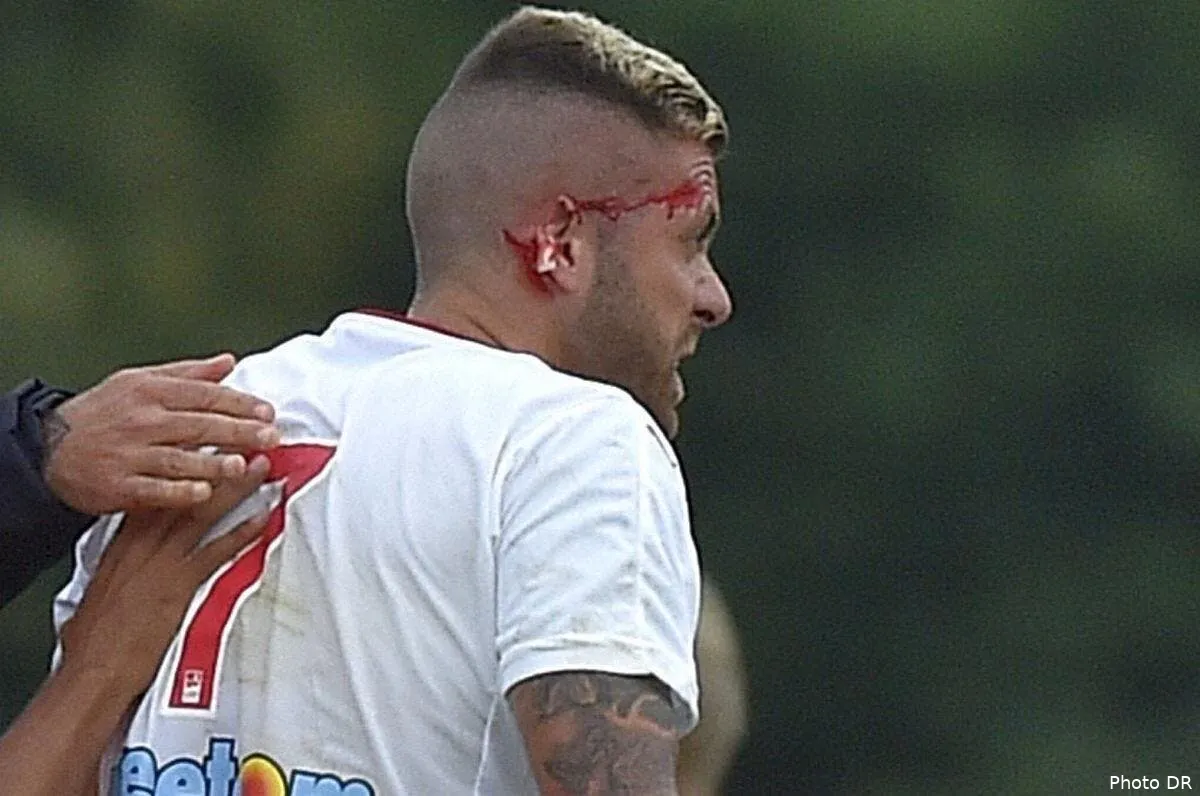 photo oreille coupee pour menez ame sensible s abstenir co9p3 owaaqi3zs150754