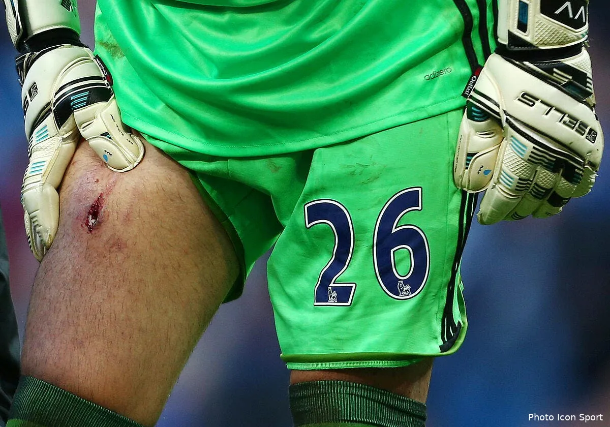 angleterre aie l impressionnante blessure de victor valdes iconsport bpi 051116 05 26160128