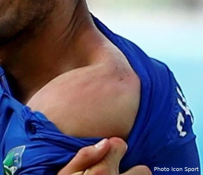 photo suarez a encore mordu la preuve capture d e cran 2014 06 24 a 20 04 3685959