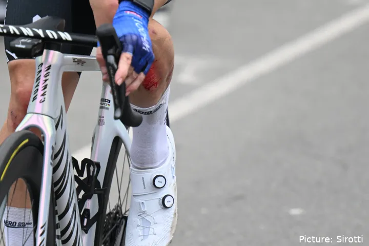 Kaden Groves visibly bloody after stage 1 crash at the 2026 Giro d'Italia