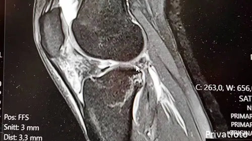 2kz6-kYS3BZP8X0CBVRqvAA9DT7-a3uch8kPy52RW89A