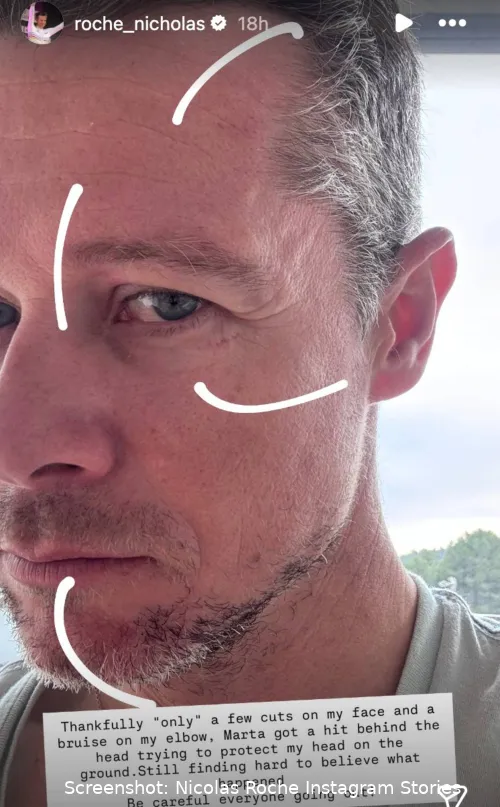 Nicolas Roche deelt op Instagram beelden van zijn verwondingen na een poging tot beroving in Barcelona