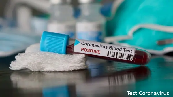 big test coronavirus