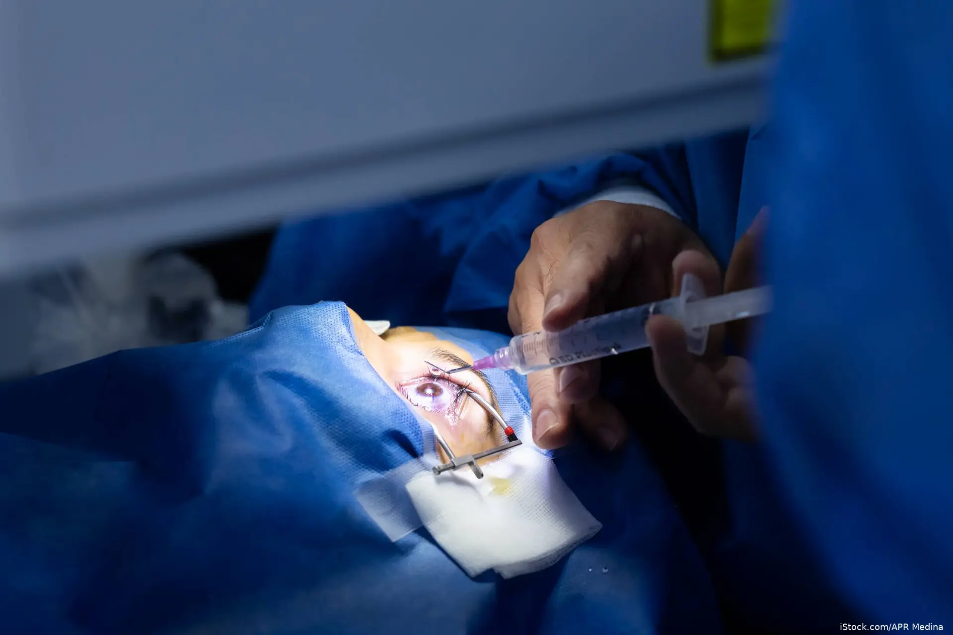 physician giving an intravitreal injection to a patient