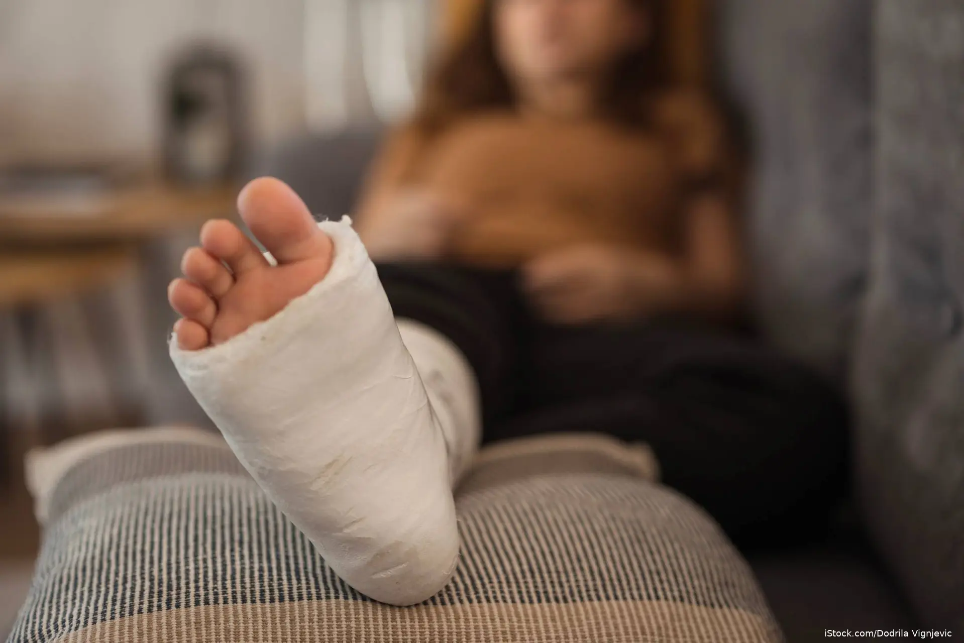 Woman on a cough with a cast on her foot and ankle