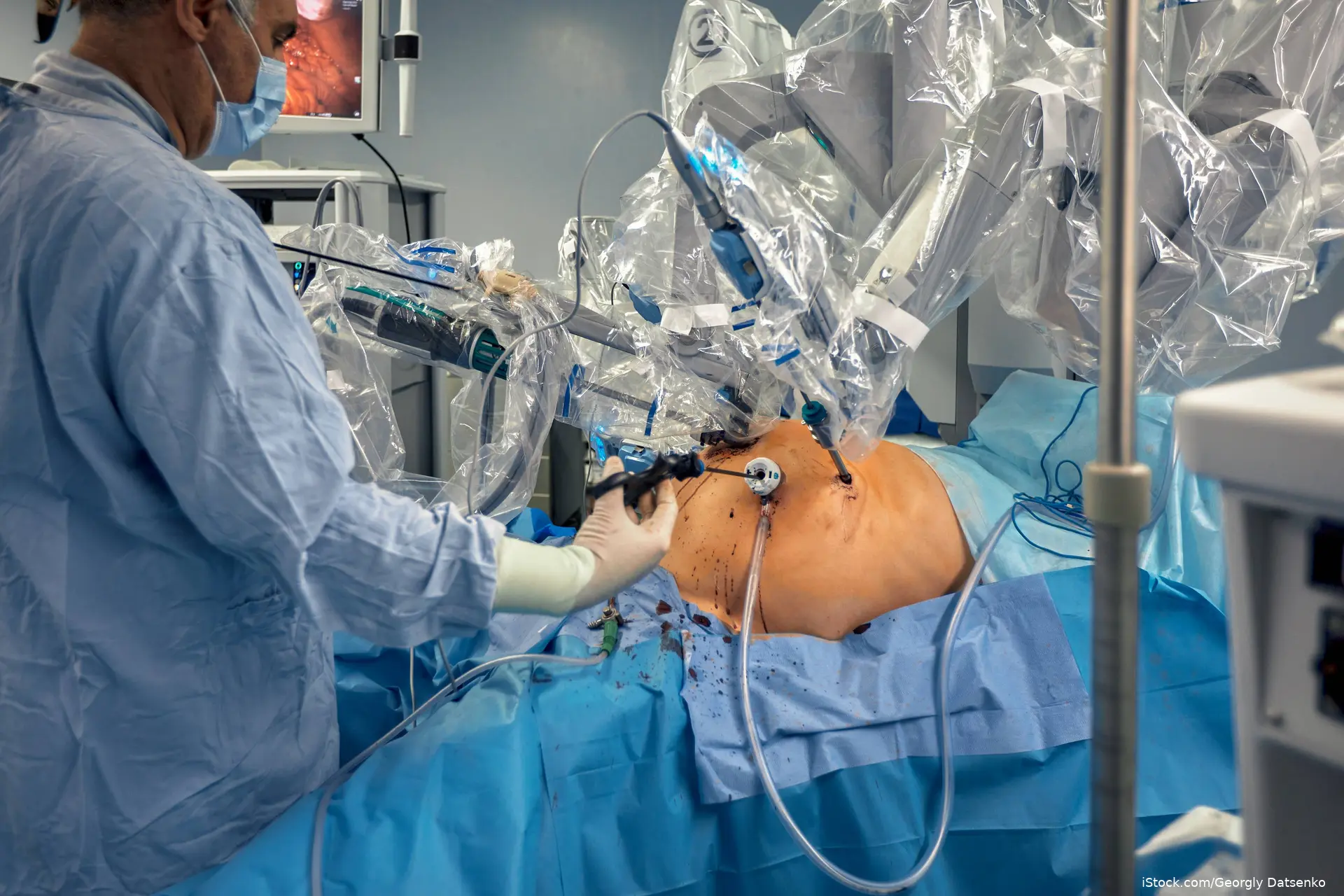 bariatric surgery in OR