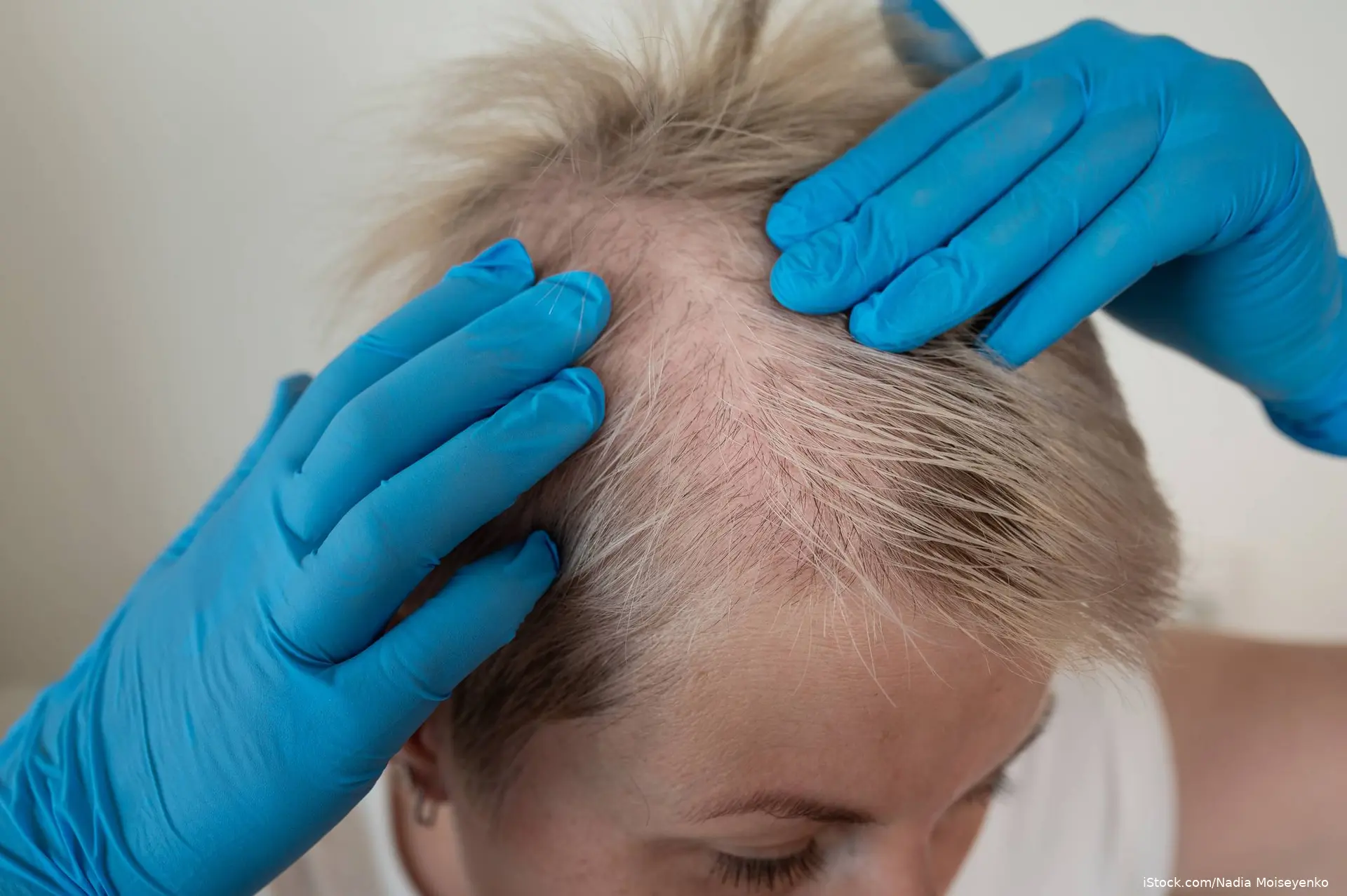 patient having their scalp examined