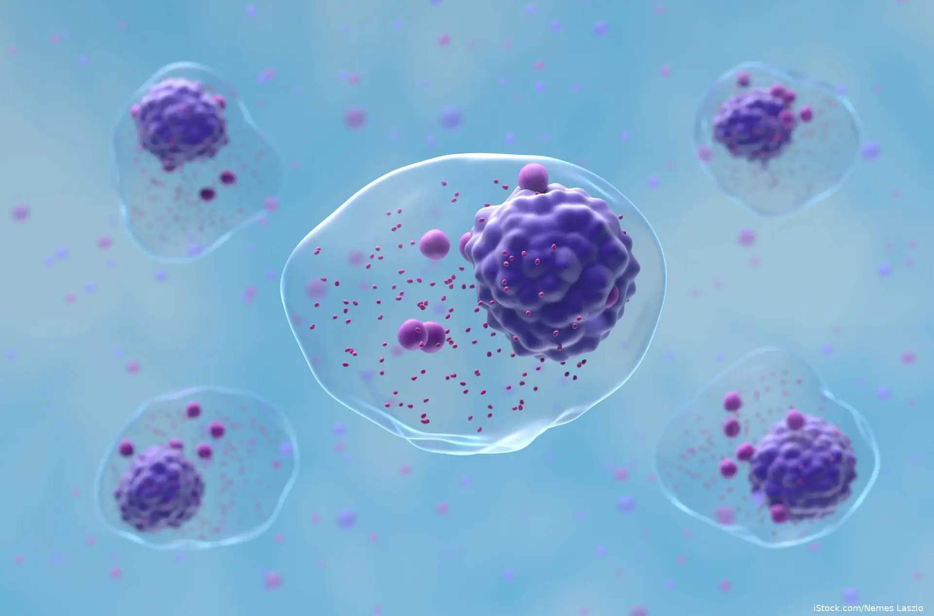 Multiple myeloma (MM) cells in the blood