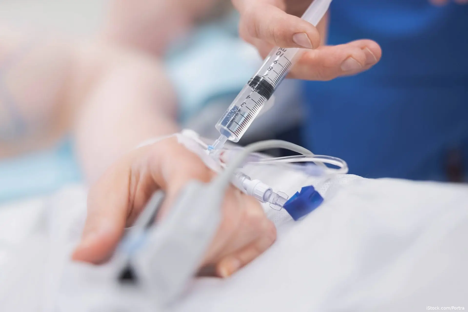 image of a patient receiving IV anesthesia