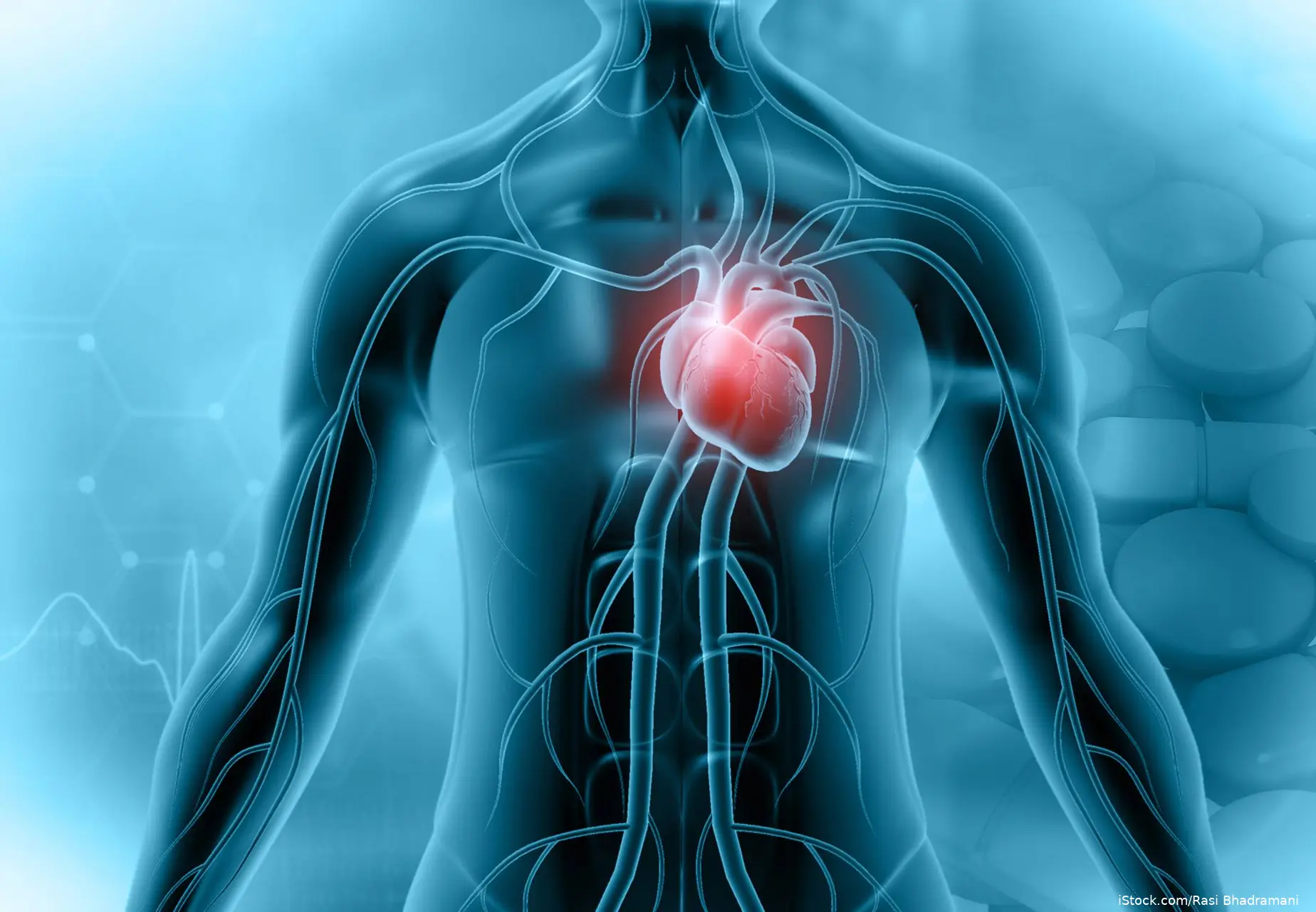 image of translucent torso showing cardiovascular inflamation
