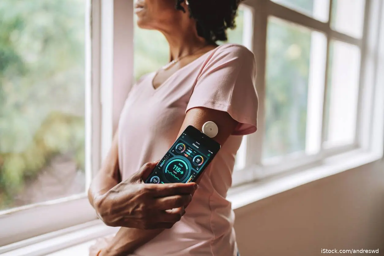 Continuous blood glucose monitor on black female patient looking out her window and smart phone gets readings