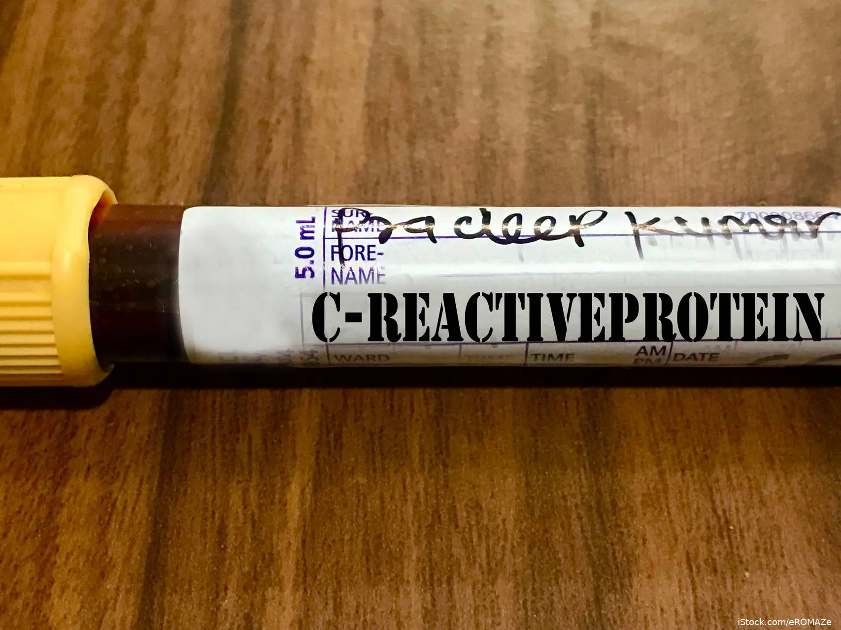 c reactive protein blood test vial