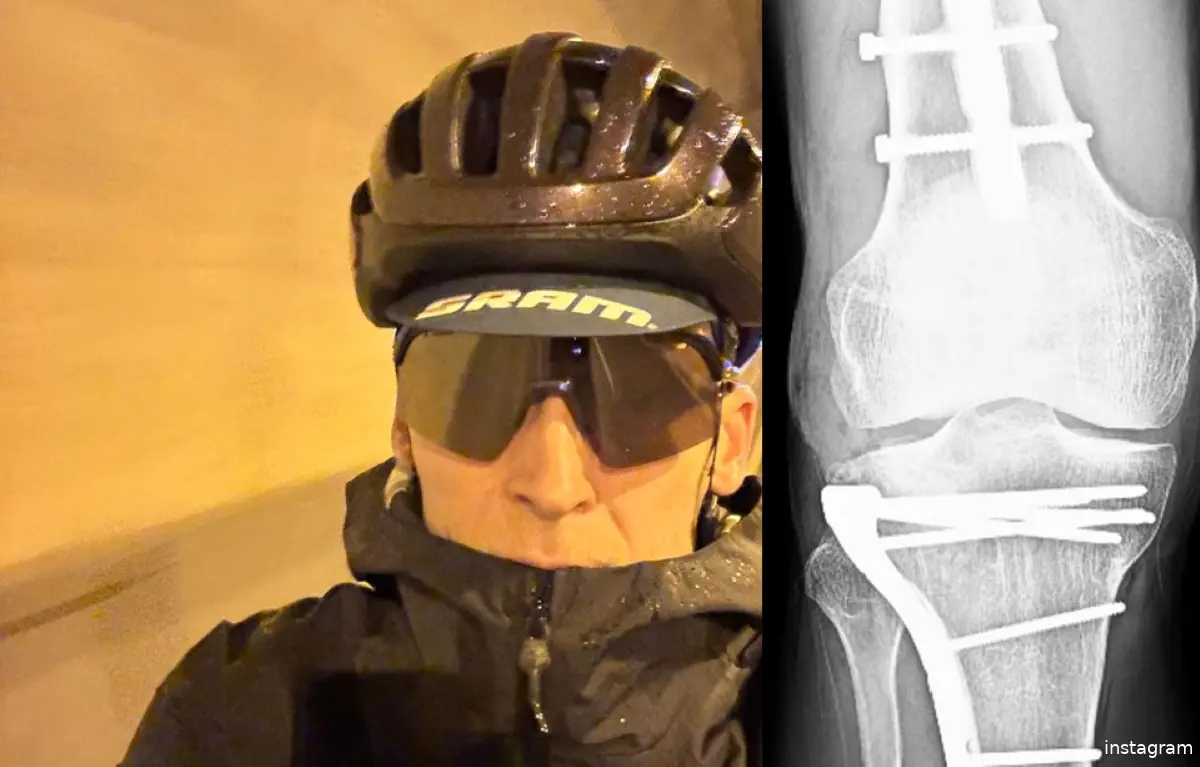 robert-gesink-knie