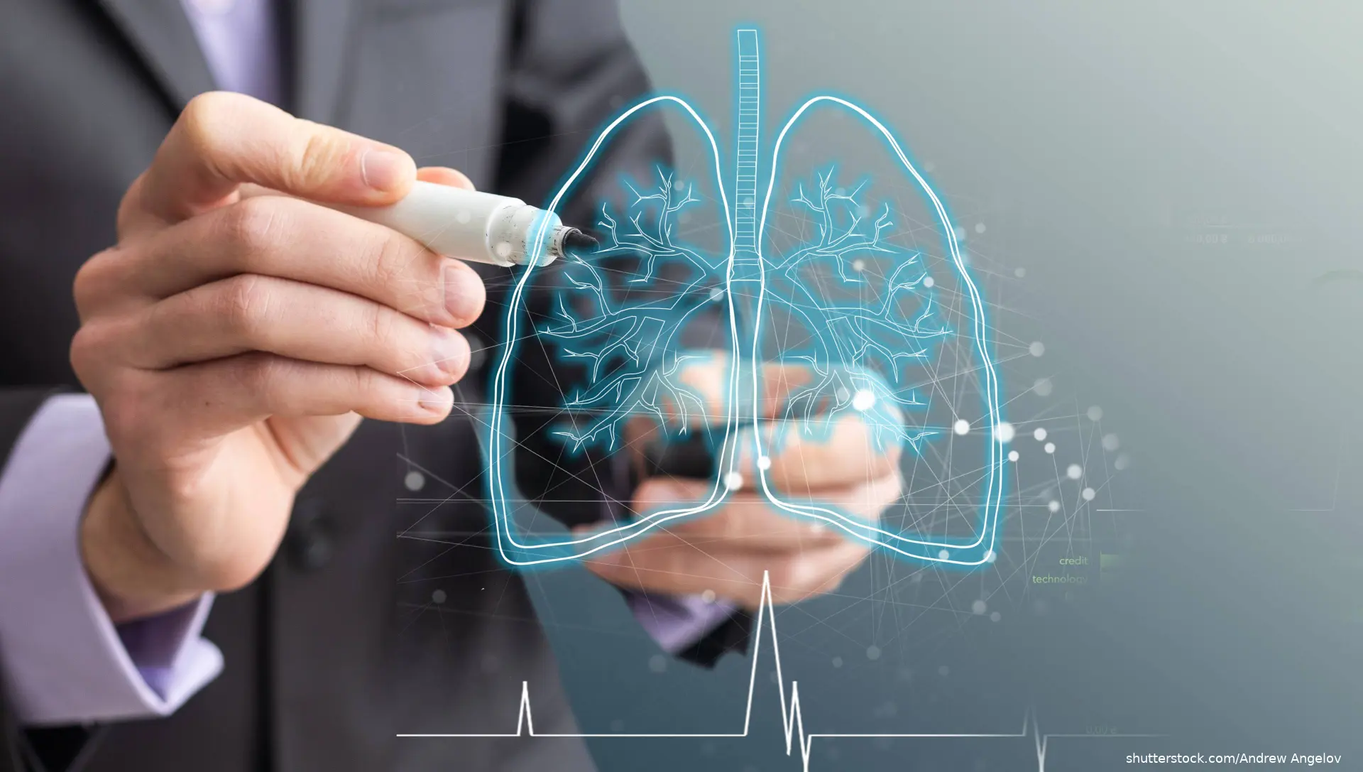 person pointing at computer image of lung
