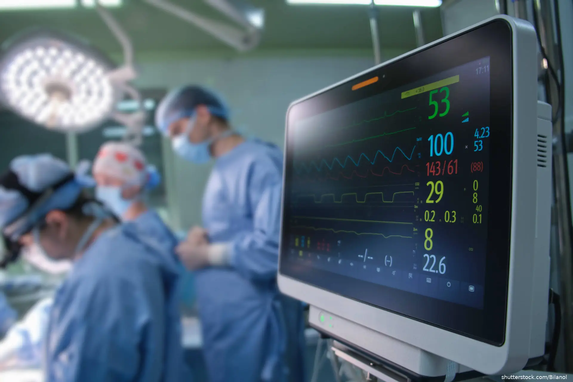 cardiac monitor in operating room