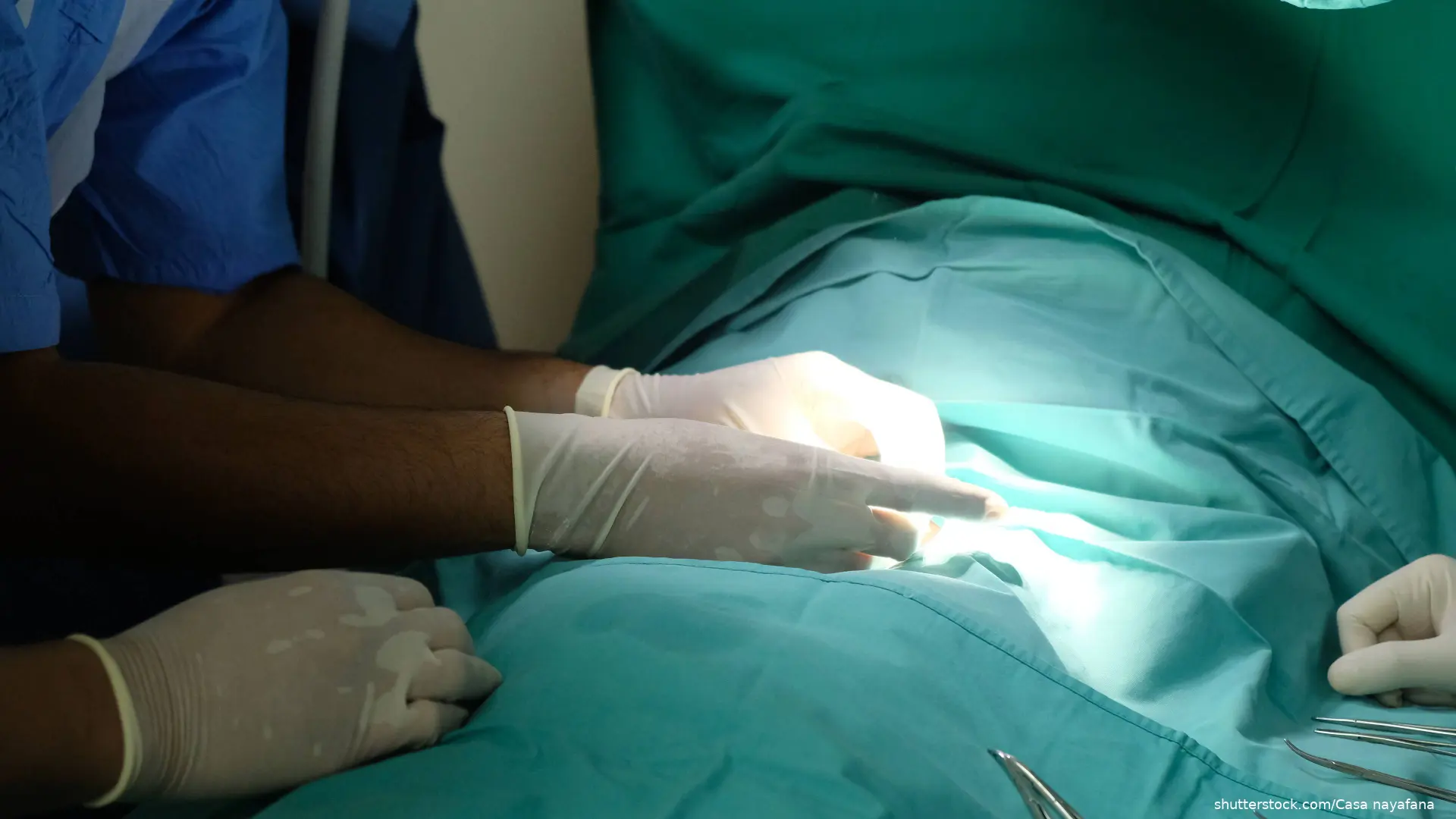doctor performing circumcision
