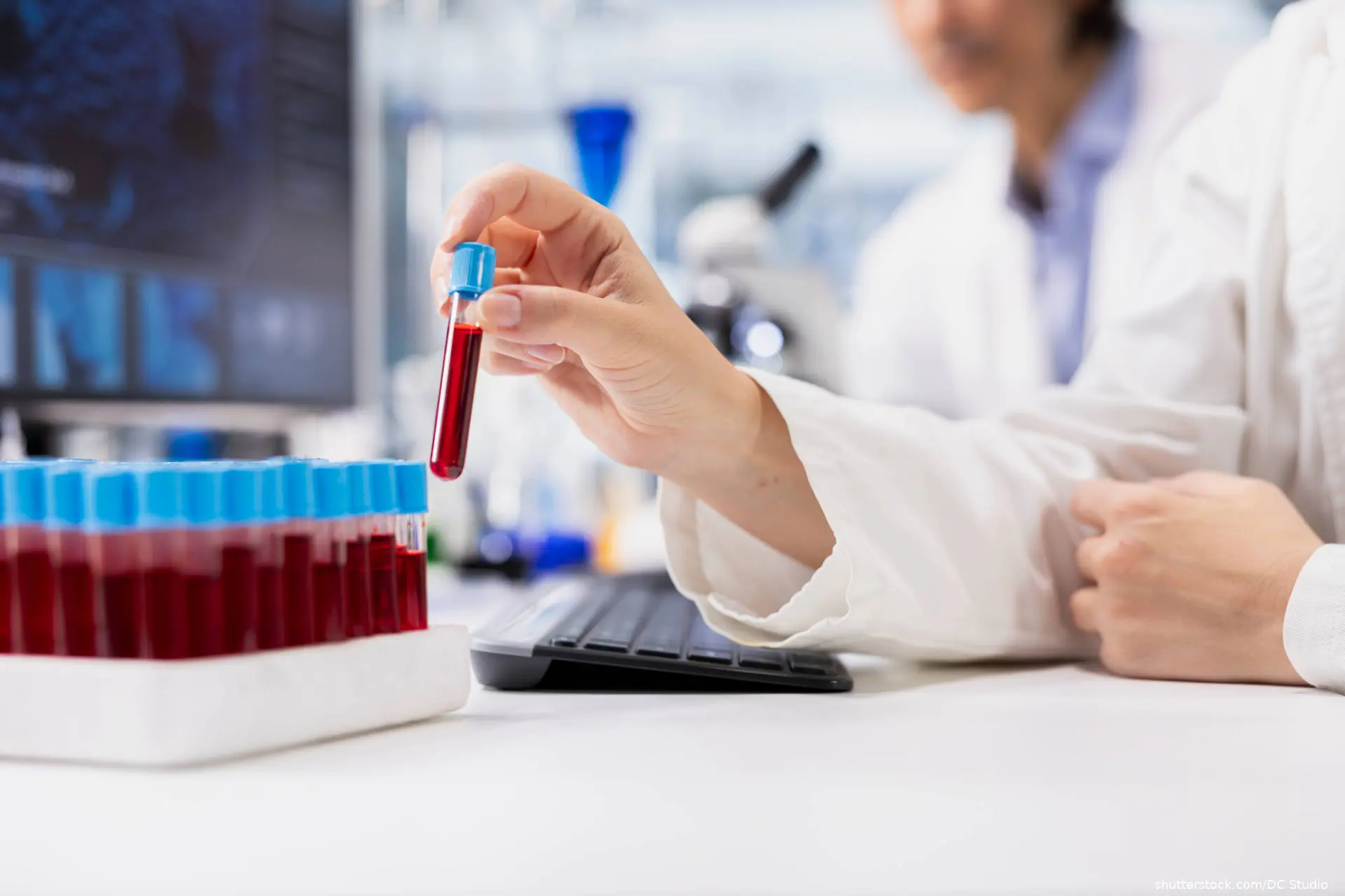 diagnostic laboratory technician looking at blood sample in test tube
