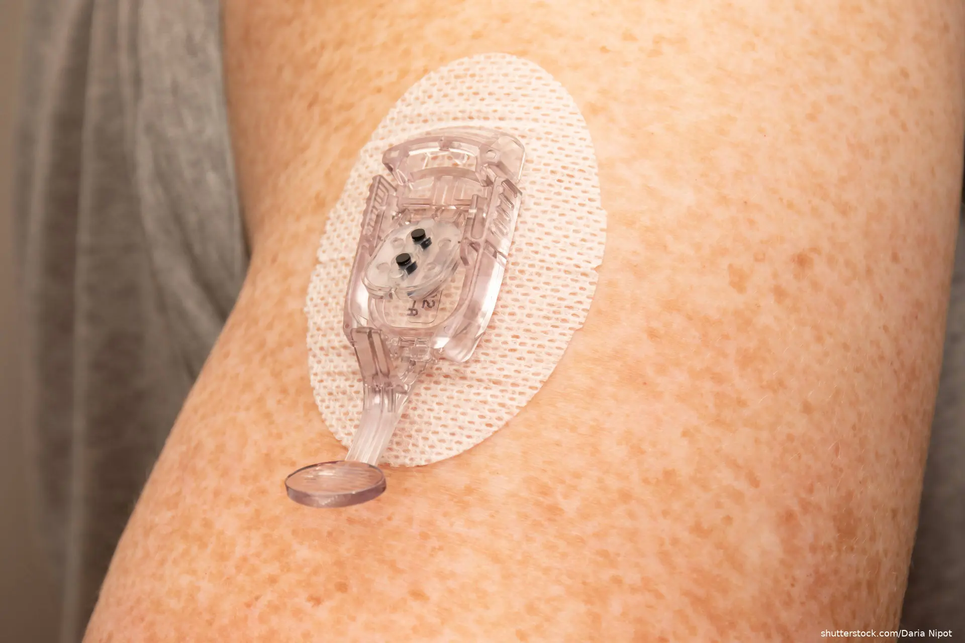 Insulin patch pump