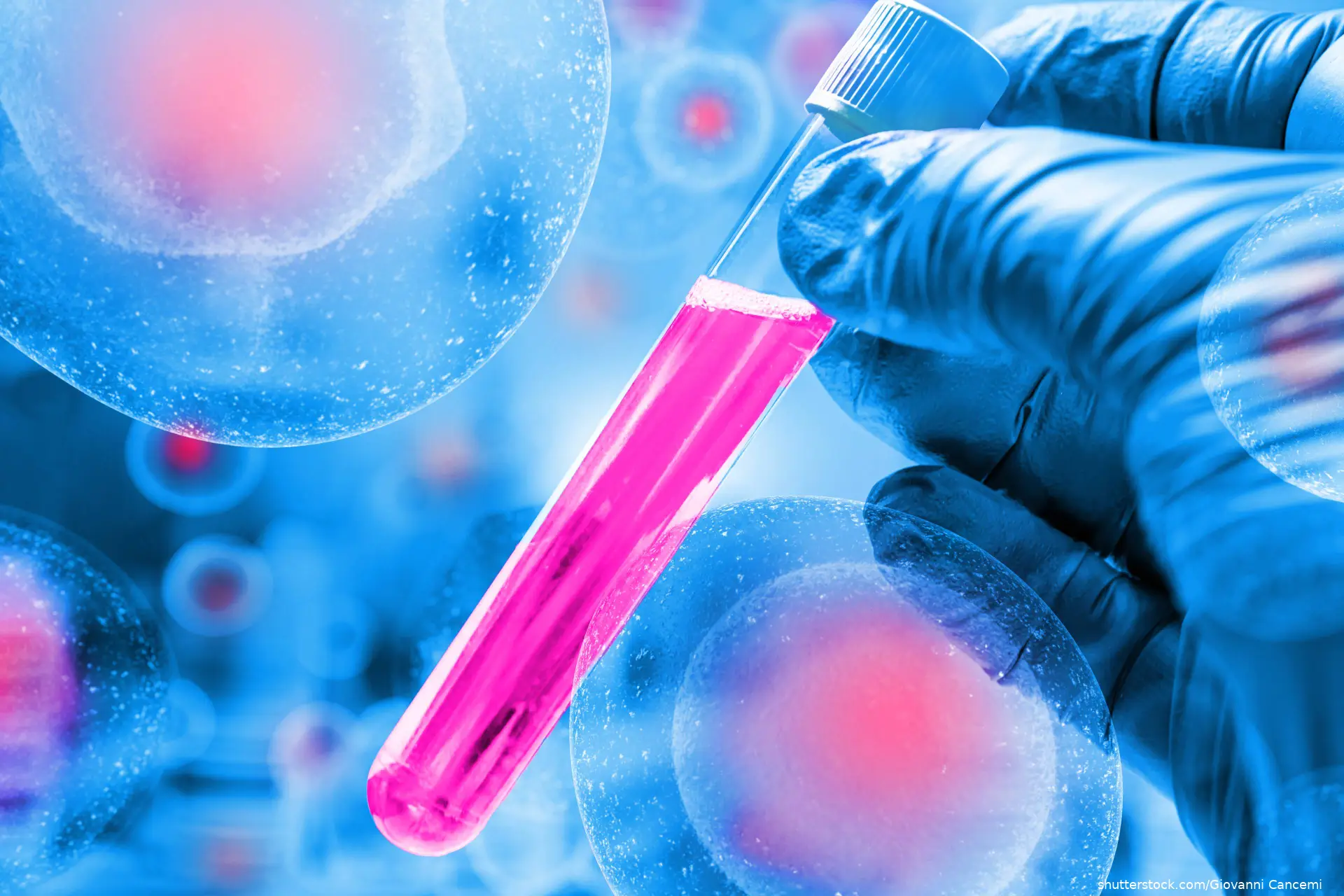 T Cells,Cancer Cells test on laboratory test tube in the analyst's hand