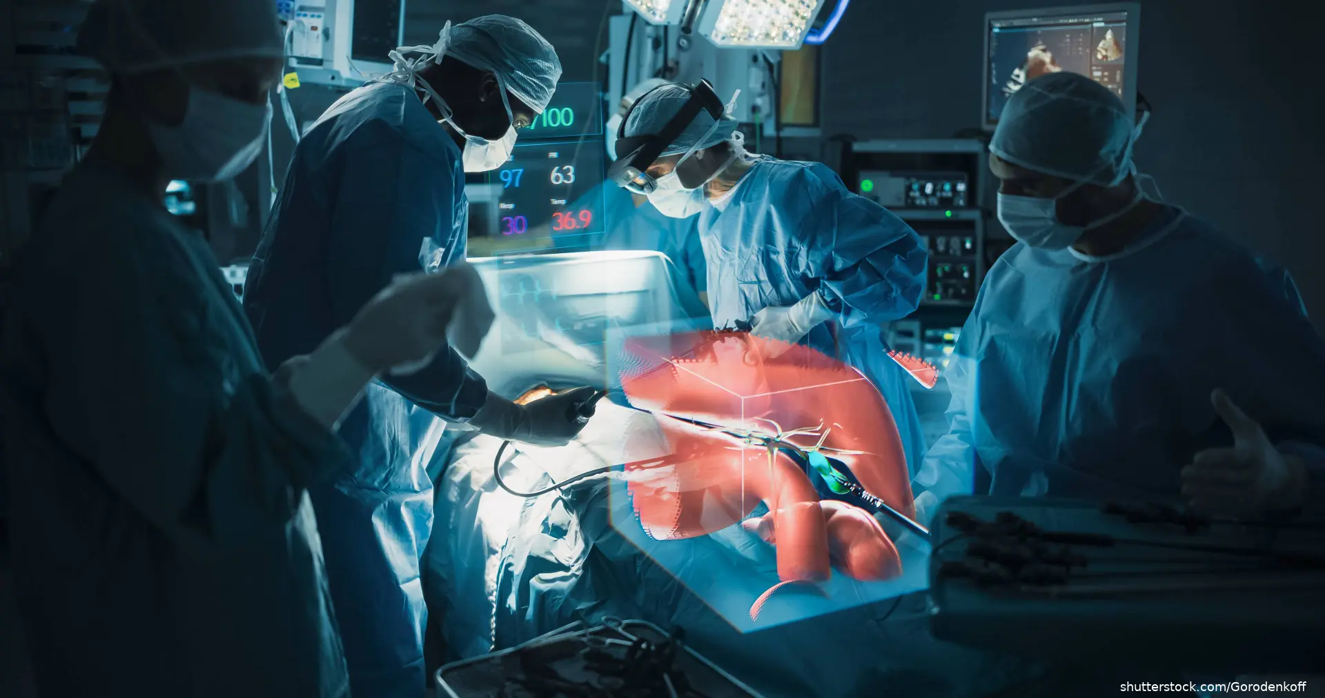 surgeons performing surgery with futuristic artificial intelligence