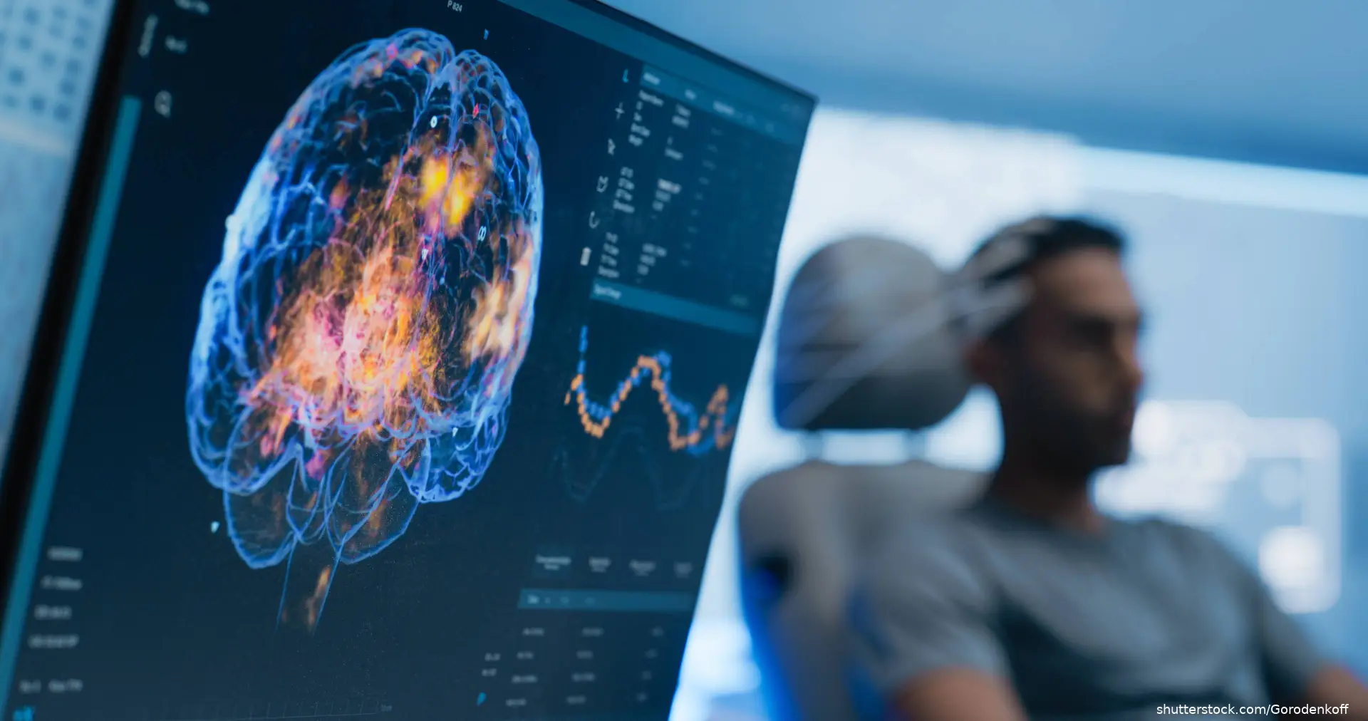 Brain Scan on Computer Screen young adult male in chair shutterstock_2579142607