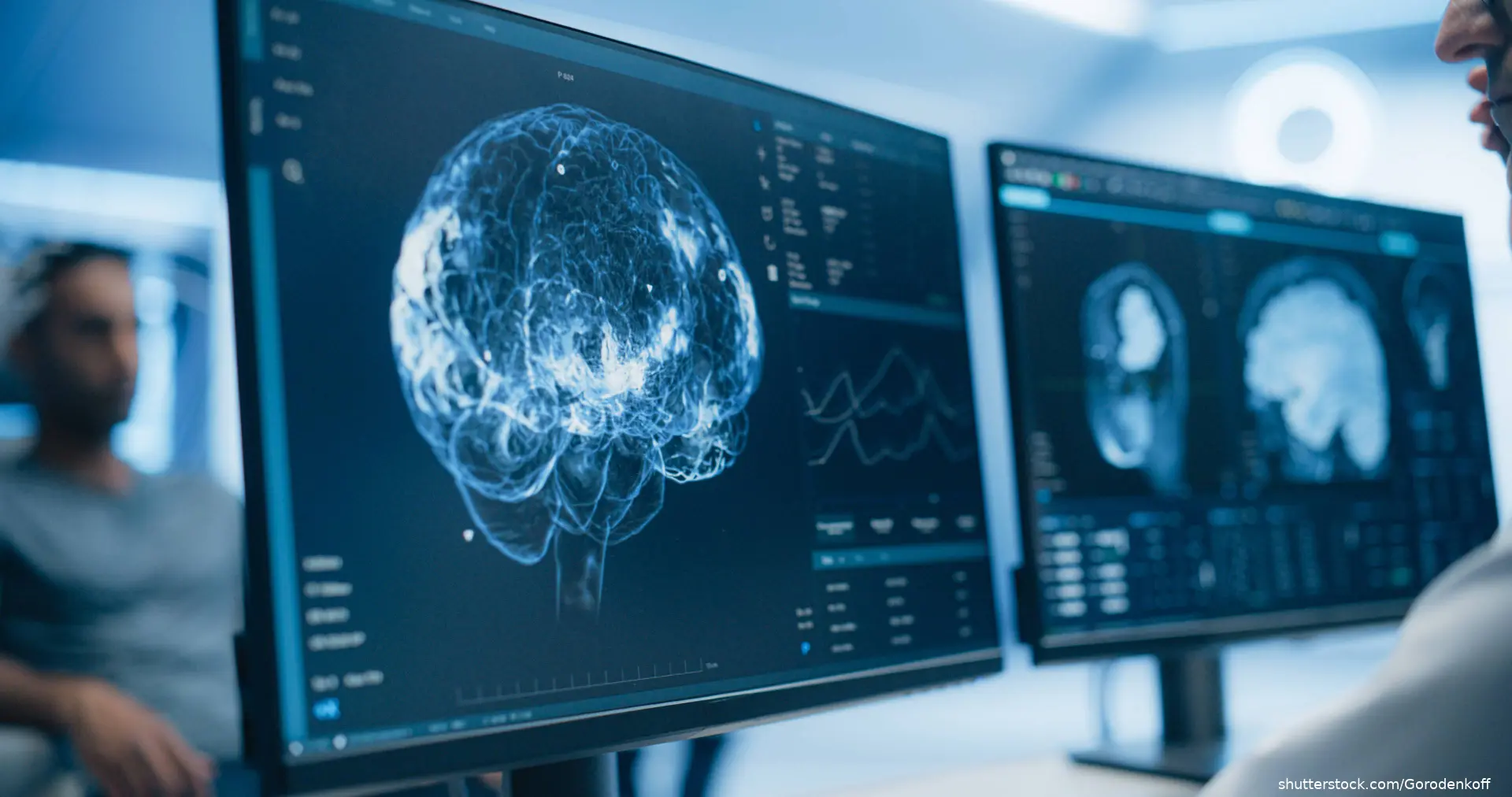 Brain Scans on Multiple Computer Screens