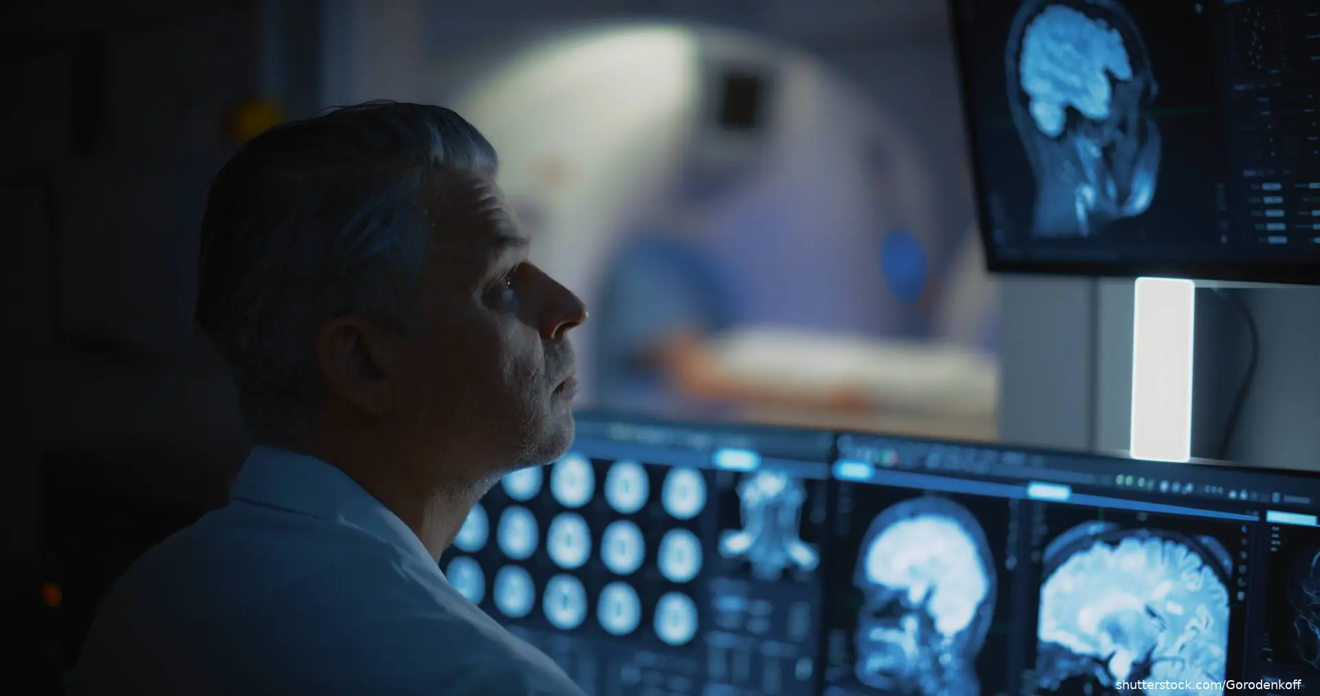 Doctor Looking at MRI or CT Scan Images on computer screen