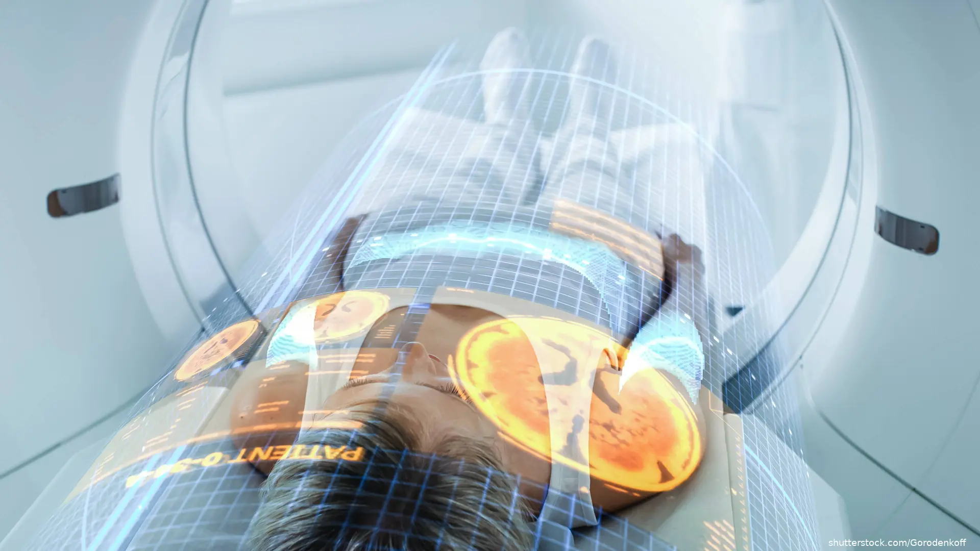 Female Patient Lying in CT scanner with computer imaging over her
