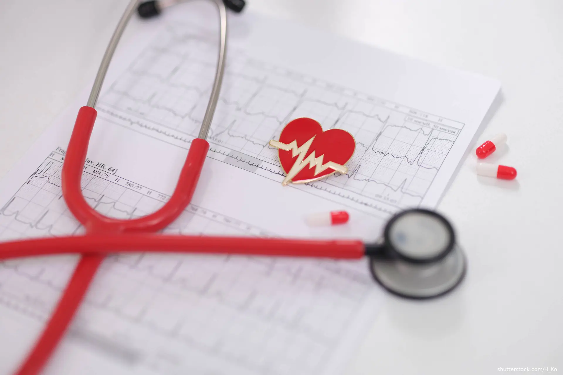 Electrocardiogram of heart and stethoscope with medications for analysis of cardiovascular disease closeup. Treatment and prevention of arrhythmia and myocardial infarction