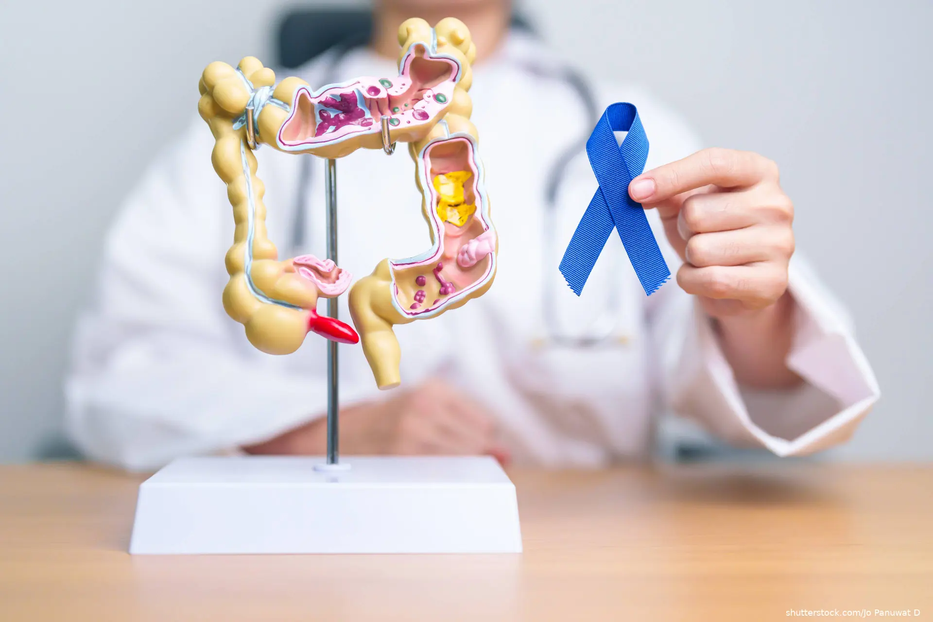 Doctor holding blue ribbon next to a model of colon