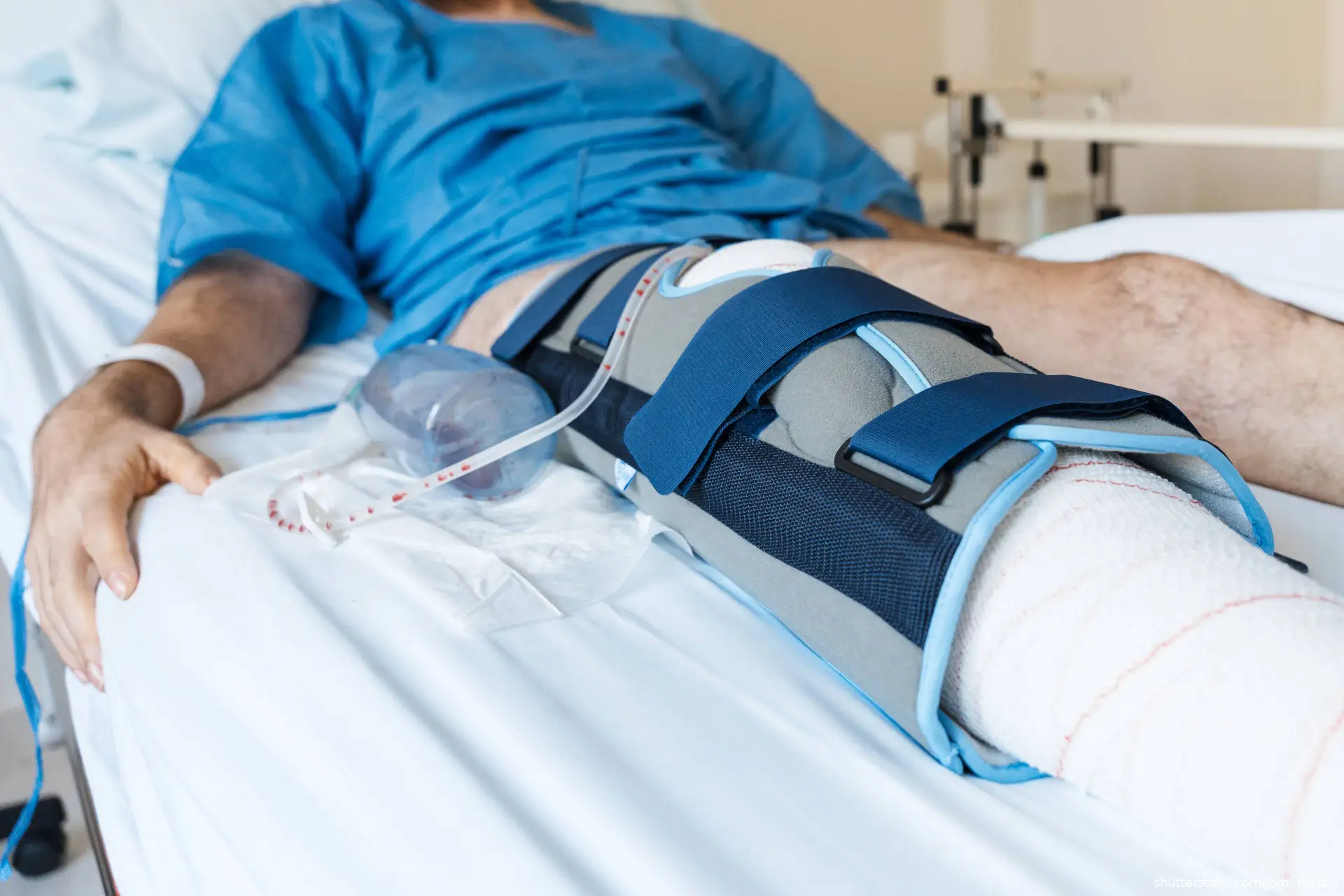Male patient lying in hospital bed after leg surgery, wearing knee brace and cast
