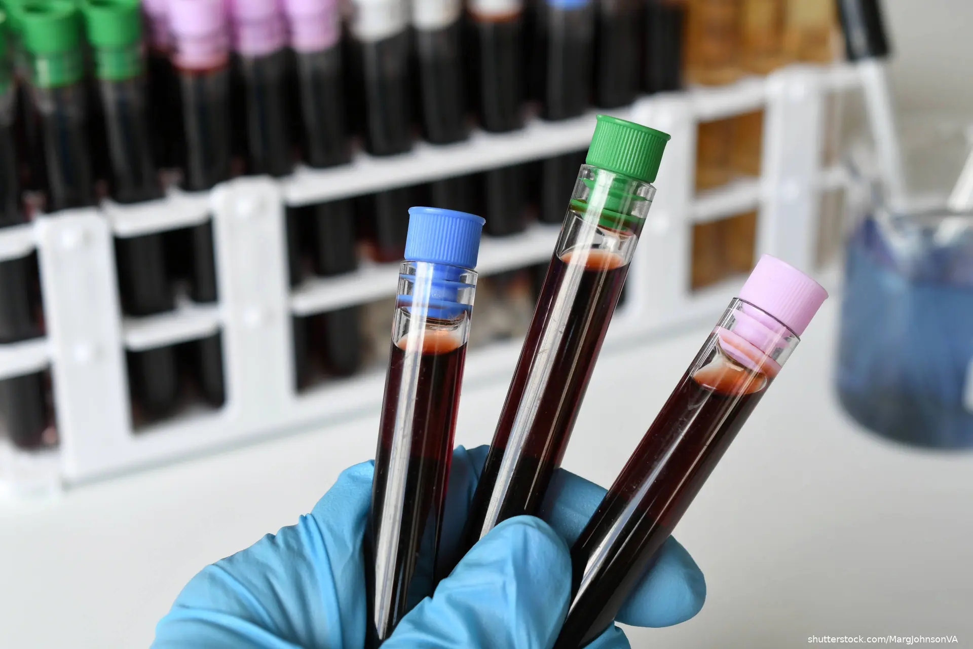medical worker lab technician holding vials of blood for testing